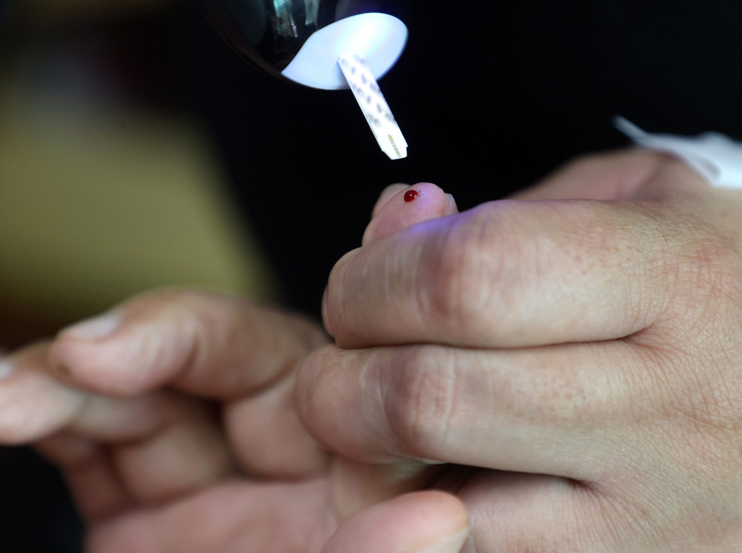 你知道治療糖尿病,還可以延緩洗腎嗎?治療糖尿病的常見迷思一次破解