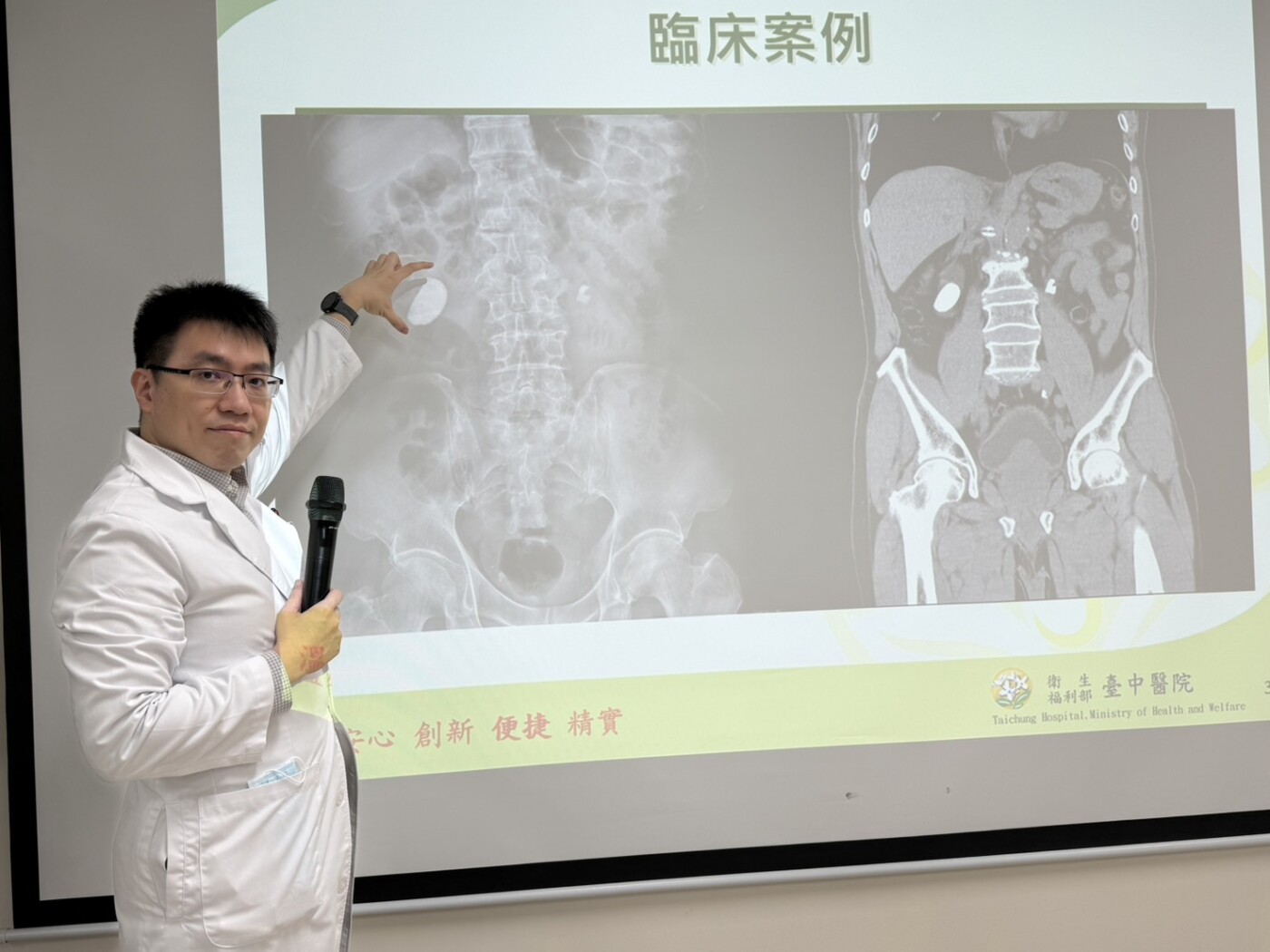 爬山健身卻藏危機 68歲男血尿就醫驚見4公分巨大結石